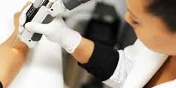 دستگاه های مورد استفاده در فرآیند لیزر موهای زائد