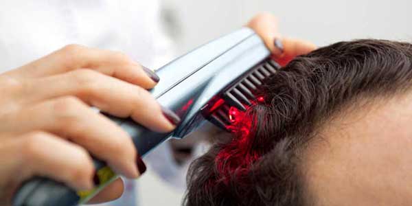 درمان ریزش مو با لیزر